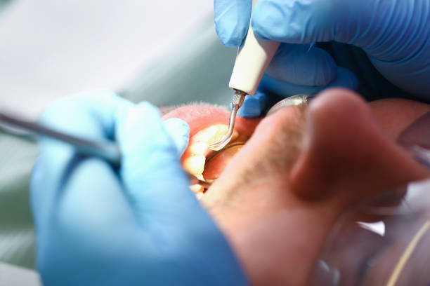 Best Emergency Dental Services for Seniors in Dunn, NC