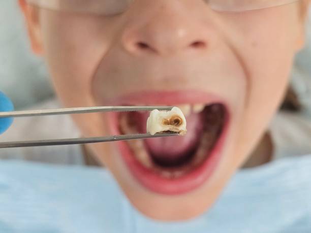 Best Emergency Dentist for Knocked-Out Tooth in Dunn, NC