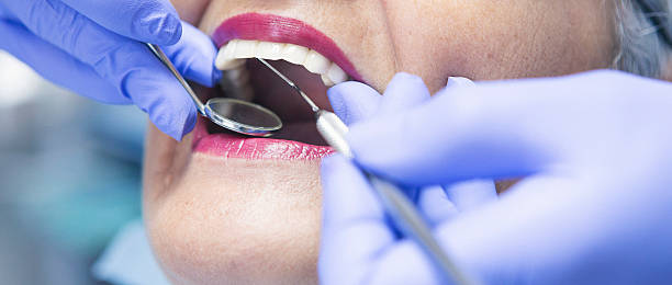 Best Emergency Dentist for Lost Fillings or Crowns in Dunn, NC